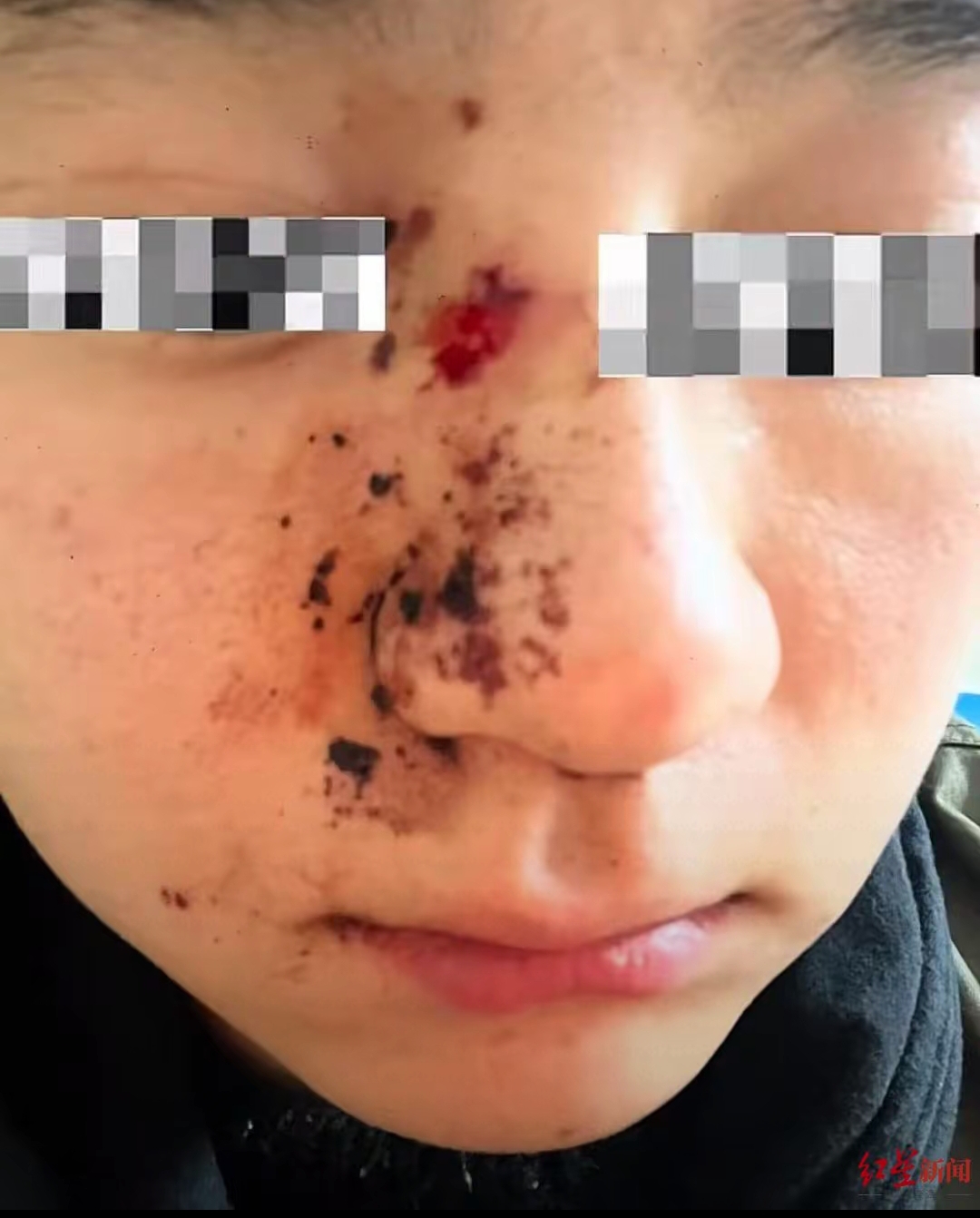 关于重庆队长受伤，球队士气受挫的信息